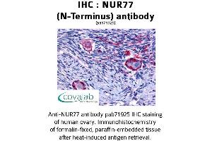 Image no. 1 for anti-Nuclear Receptor Subfamily 4, Group A, Member 1 (NR4A1) (N-Term) antibody (ABIN1737606)