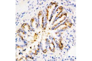 Anti-Calpain 1 antibody, IHC(P) IHC(P): Rat Lung Tissue (CAPNL1 anticorps  (Middle Region))