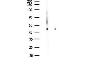 Western blot analysis of lysates from HepG2 cells(heat-shock,45 min treatment), using ALS2CR4 Antibody at 1/1000 dilution.