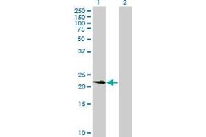 Western Blot analysis of PDGFA expression in transfected 293T cell line by PDGFA MaxPab polyclonal antibody. (PDGFA anticorps  (AA 1-211))