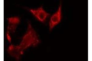 ABIN6275351 staining NIH-3T3 cells by IF/ICC. (PEX7 anticorps  (C-Term))