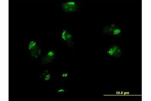 Immunofluorescence of purified MaxPab antibody to GOSR1 on HeLa cell. (GS28 anticorps  (AA 1-250))