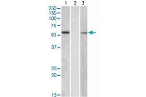 HEK293 lysate (10 ug protein in RIPA buffer) overexpressing human MGAT1 with C-terminal MYC tag probed with MGAT1 polyclonal antibody (Cat # PAB18956, 1 ug/mL) in Lane A and probed with anti-MYC Tag (1/1000) in lane C. (MGAT1 anticorps  (Internal Region))