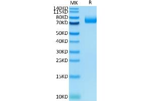 Mouse CD36 on Tris-Bis PAGE under reduced condition. (CD36 Protein (CD36) (AA 30-439) (His tag))