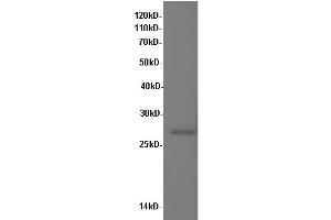 Western Blotting (WB) image for anti-Interleukin 10 (IL10) antibody (ABIN5957052) (IL-10 anticorps)