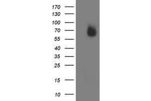 Western Blotting (WB) image for anti-Interferon Regulatory Factor 6 (IRF6) antibody (ABIN1498900)