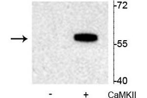 Western blot of recombinant tryptophan hydroxylase incubated in the absence (-) and presence (+) of  Ca2+/calmodulin dependent kinase II showing specific immunolabeling of the ~55 kDa tryptophan hydroxylase protein phosphorylated at Ser19. (Tryptophan Hydroxylase 2 anticorps  (pSer19))