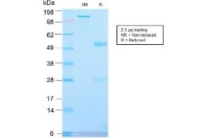 SDS-PAGE Analysis Purified PLAP Rabbit Recombinant Monoclonal Antibody (ALPP/2899R).