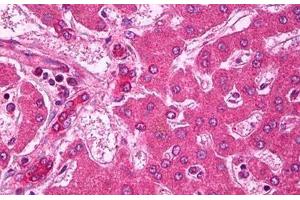 anti-ATP-Binding Cassette, Sub-Family A (ABC1), Member 1 (ABCA1) (AA 116-130) antibody