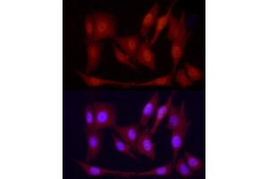 Immunofluorescence analysis of PC-12 cells using PGC1α Rabbit pAb  at dilution of 1:100 (40x lens). (PPARGC1A anticorps  (C-Term))