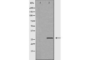 Western blot analysis of HT29 cell lysate, using CEACAM3 Antibody. (CEACAM3 anticorps  (Internal Region))