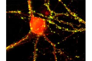 Immunostaining of hippocampus neurons with anti-densin (dilution 1 : 500, red) and anti-synapsin (, dilution 1 : 500, green).