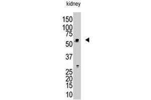 The RBCK1 polyclonal antibody  is used in Western blot to detect RBCK1 in mouse kidney tissue lysate. (RBCK1 anticorps  (N-Term))