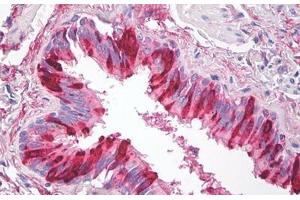 Image no. 1 for anti-Secretory Leukocyte Peptidase Inhibitor (SLPI) antibody (ABIN1502309)