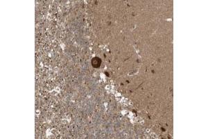 Immunohistochemical staining (Formalin-fixed paraffin-embedded sections) of human cerebellum with ALS2CR8 polyclonal antibody  shows strong cytoplasmic and nucleolar positivity in Purkinje cells.