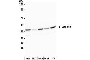Western Blotting (WB) image for anti-Actin Related Protein 2/3 Complex, Subunit 1B, 41kDa (ARPC1B) (AA 322-372) antibody (ABIN7449981)