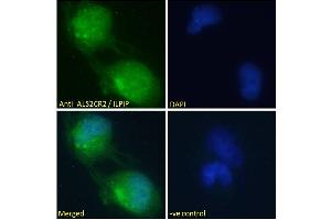 ABIN184938 Immunofluorescence analysis of paraformaldehyde fixed U251 cells, permeabilized with 0.