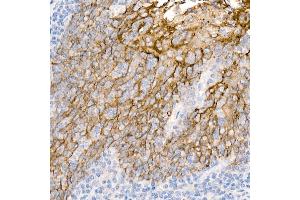 Immunohistochemistry of paraffin-embedded Human tonsil using TROP-2 antibody (ABIN7271103) at dilution of 1:2700 (40x lens).