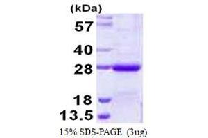 Image no. 1 for NFKB Inhibitor Interacting Ras-Like 2 (NKIRAS2) (AA 1-191) protein (His tag) (ABIN1098266)