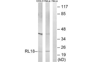 Western blot analysis of extracts from COLO cells and HeLa cells, using RPL18 antibody. (RPL18 anticorps  (Internal Region))