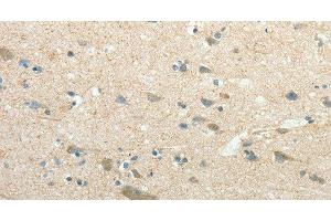 Immunohistochemistry of paraffin-embedded Human brain using SIRT3 Polyclonal Antibody at dilution of 1:30 (SIRT3 anticorps)