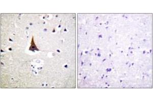 Immunohistochemistry analysis of paraffin-embedded human brain tissue, using VAV2 (Ab-142) Antibody. (VAV2 anticorps  (AA 108-157))