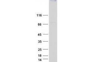 Validation with Western Blot