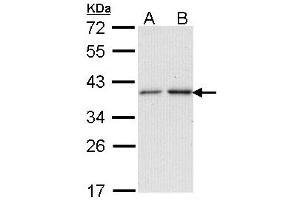 Western Blotting (WB) image for anti-N-Acetyltransferase 2 (Arylamine N-Acetyltransferase) (NAT2) (AA 1-168) antibody (ABIN467624) (NAT2 anticorps  (AA 1-168))