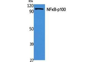 Western Blot (WB) analysis of specific cells using NFkappaB-p100 Polyclonal Antibody. (NFKB2 anticorps  (Thr160))
