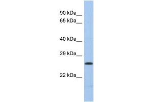 Western Blotting (WB) image for anti-Polymerase (DNA Directed), lambda (POLL) (Middle Region) antibody (ABIN2785954) (POLL anticorps  (Middle Region))