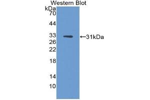 Western blot analysis of the recombinant protein. (DCT anticorps  (AA 28-263))