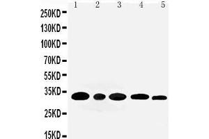 Anti-Aquaporin 3 antibody, Western blotting Lane 1: Rat Kidney Tissue Lysate Lane 2: Rat Lung Tissue Lysate Lane 3: Mouse Kidney Tissue Lysate Lane 4: M453 Cell Lysate Lane 5: MMC Cell Lysate (AQP3 anticorps  (C-Term))