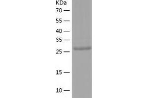 Western Blotting (WB) image for Caspase 1 (CASP1) (AA 120-404) protein (His-IF2DI Tag) (ABIN7122161)