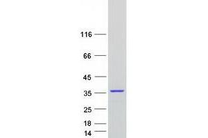 Validation with Western Blot
