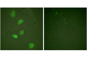 Immunofluorescence analysis of HeLa cells, using HDAC3 (Ab-424) Antibody. (HDAC3 anticorps  (AA 379-428))