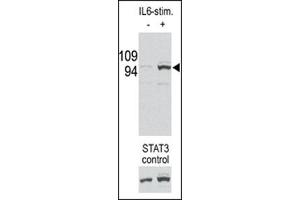 Image no. 1 for anti-Signal Transducer and Activator of Transcription 3 (Acute-Phase Response Factor) (STAT3) (pSer727) antibody (ABIN358233) (STAT3 anticorps  (pSer727))