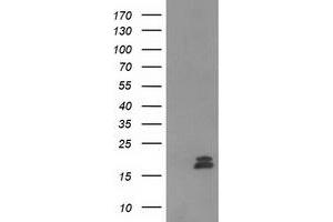 Western Blotting (WB) image for anti-Chromosome 2 Open Reading Frame 40 (C2orf40) antibody (ABIN1497049) (C2orf40 anticorps)