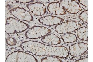 anti-Calcium and Integrin-Binding Protein 1 (CIB1) (AA 1-191) antibody