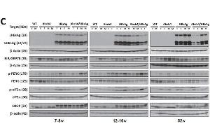 Western blotting using ABIN285516 demonstrates reduced expression of HBsAg and ER stress in Abcb4−/−/HBsAg+/− mice. (HBSAg anticorps)