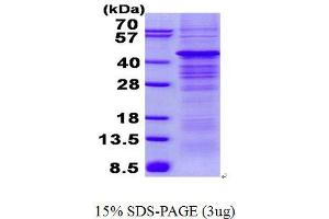 Image no. 1 for Protein Kinase, AMP-Activated, beta 1 Non-Catalytic Subunit (PRKAB1) protein (His tag) (ABIN7280002)
