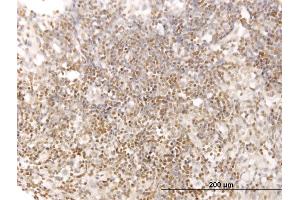 Immunoperoxidase of monoclonal antibody to STAT5B on formalin-fixed paraffin-embedded human lymph node. (STAT5B anticorps  (AA 678-787))