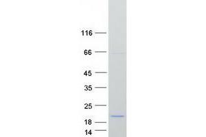 Programmed Cell Death 5 (PDCD5) protein (Myc-DYKDDDDK Tag)