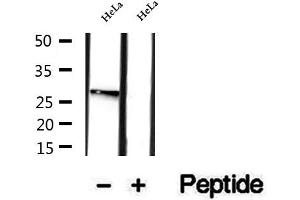 Western blot analysis of extracts of HeLa cells, using RAB12 antibody.