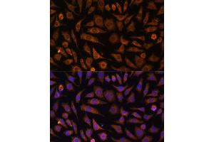 Immunofluorescence analysis of L929 cells using RA antibody (ABIN7269797) at dilution of 1:100.