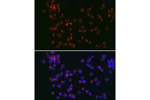 Immunofluorescence analysis of Jurkat cells using TLR6 Rabbit pAb (ABIN7270847) at dilution of 1:150 (40x lens). (TLR6 anticorps  (AA 32-200))