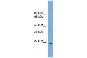 WB Suggested Anti-CTF1 Antibody Titration: 0.