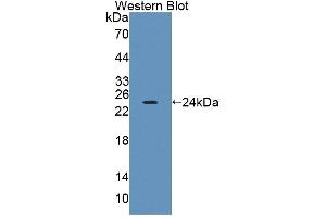 Western blot analysis of the recombinant protein. (PTPRA anticorps  (AA 624-800))