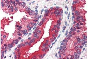Human Prostate (formalin-fixed, paraffin-embedded) stained with EIF2AK2 antibody ABIN214488 at 2. (EIF2AK2 anticorps  (C-Term))