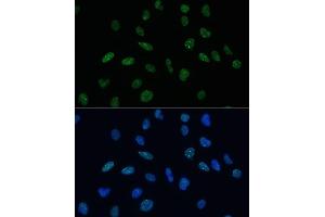 Immunofluorescence analysis of U-2 OS cells using MKL1 Polyclonal Antibody (ABIN6132380, ABIN6143855, ABIN6143858 and ABIN6224589) at dilution of 1:100 (40x lens). (MKL1 anticorps  (AA 1-280))