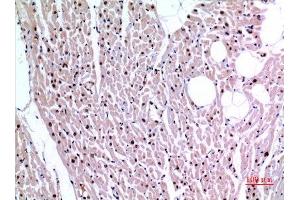 Immunohistochemistry (IHC) analysis of paraffin-embedded Human Heart, antibody was diluted at 1:100. (XRCC6 anticorps  (Ser404))